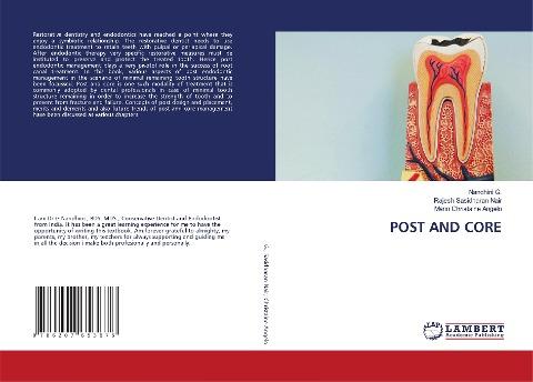 POST AND CORE