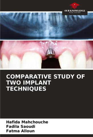 COMPARATIVE STUDY OF TWO IMPLANT TECHNIQUES