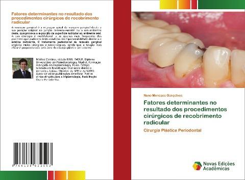 Fatores determinantes no resultado dos procedimentos cirúrgicos de recobrimento radicular
