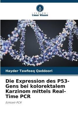 Die Expression des P53-Gens bei kolorektalem Karzinom mittels Real-Time PCR