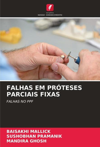 FALHAS EM PRÓTESES PARCIAIS FIXAS