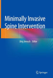 Minimally Invasive Spine Intervention