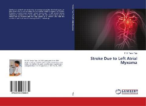 Stroke Due to Left Atrial Myxoma