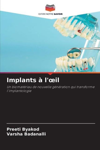Implants à l'¿il