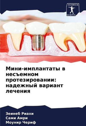 Mini-implantaty w nes#emnom protezirowanii: nadezhnyj wariant lecheniq