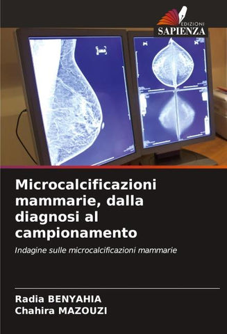 Microcalcificazioni mammarie, dalla diagnosi al campionamento