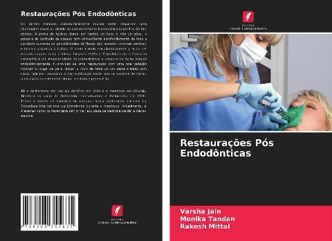 Restaurações Pós Endodônticas
