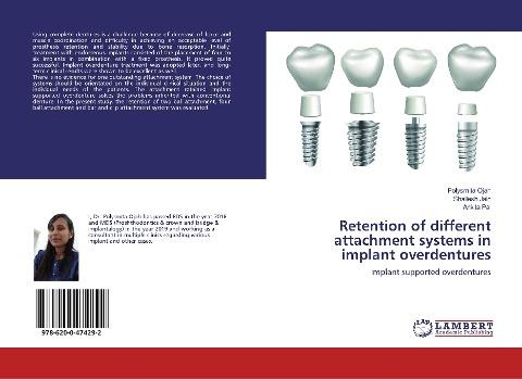 Retention of different attachment systems in implant overdentures