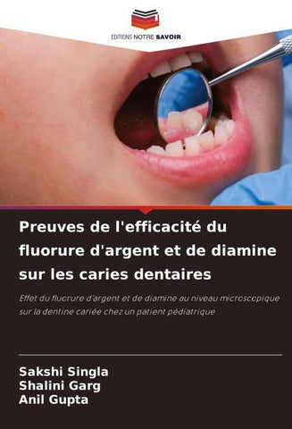 Preuves de l'efficacité du fluorure d'argent et de diamine sur les caries dentaires
