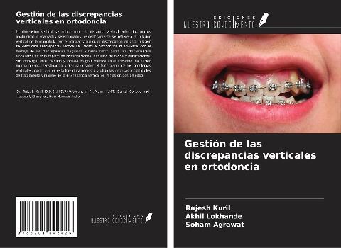 Gestión de las discrepancias verticales en ortodoncia