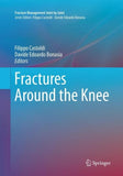Fractures Around the Knee
