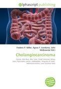 Cholangiocarcinoma