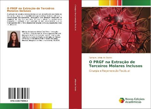 O PRGF na Extração de Terceiros Molares Inclusos