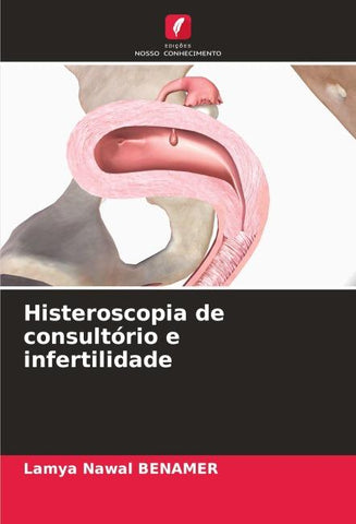 Histeroscopia de consultório e infertilidade