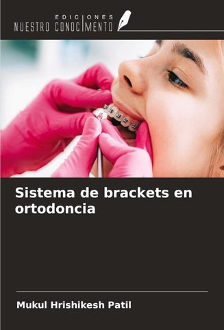 Sistema de brackets en ortodoncia