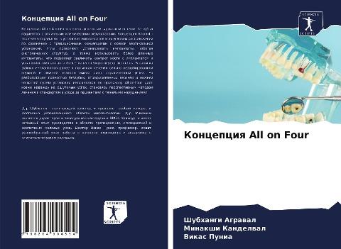 Koncepciq All on Four