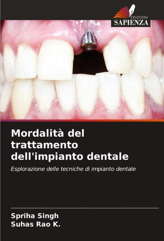 Mordalità del trattamento dell'impianto dentale