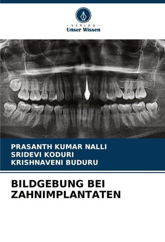 BILDGEBUNG BEI ZAHNIMPLANTATEN
