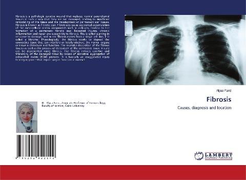 Fibrosis
