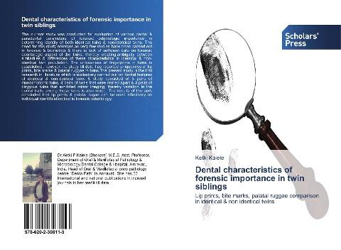 Dental characteristics of forensic importance in twin siblings