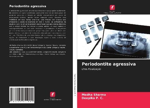 Periodontite agressiva