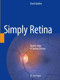 Simply Retina