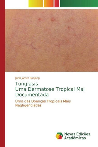 TungiasisUma Dermatose Tropical Mal Documentada