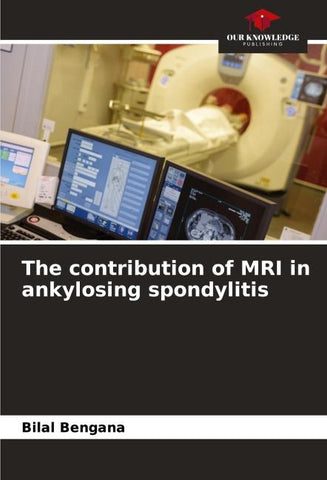 The contribution of MRI in ankylosing spondylitis