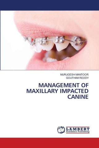 MANAGEMENT OF MAXILLARY IMPACTED CANINE