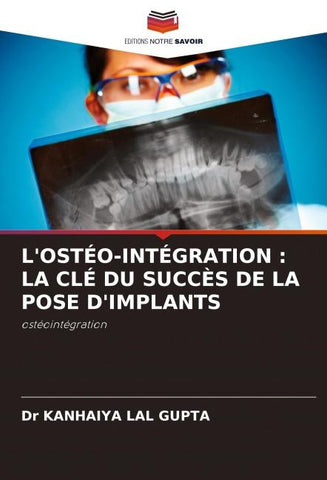 L'OSTÉO-INTÉGRATION : LA CLÉ DU SUCCÈS DE LA POSE D'IMPLANTS