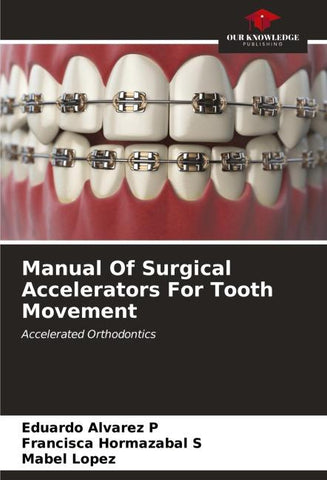 Manual Of Surgical Accelerators For Tooth Movement