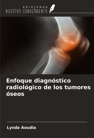 Enfoque diagnóstico radiológico de los tumores óseos