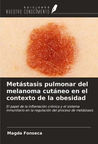 Metástasis pulmonar del melanoma cutáneo en el contexto de la obesidad