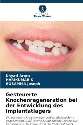 Gesteuerte Knochenregeneration bei der Entwicklung des Implantatlagers