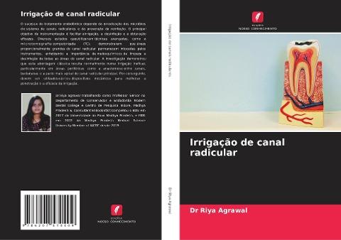 Irrigação de canal radicular