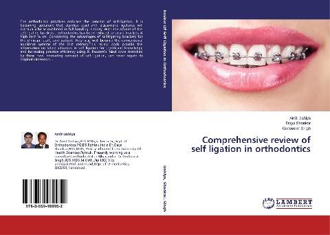Comprehensive review of self ligation in orthodontics