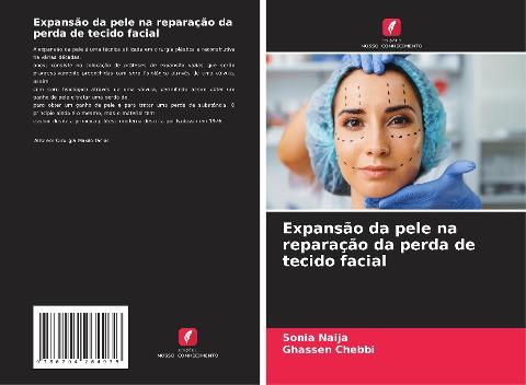 Expansão da pele na reparação da perda de tecido facial