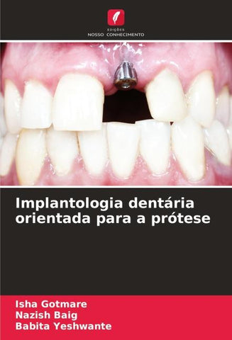 Implantologia dentária orientada para a prótese
