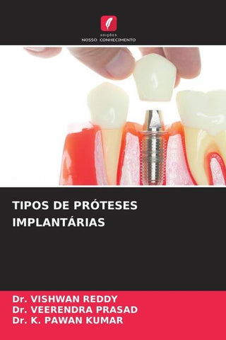TIPOS DE PRÓTESES IMPLANTÁRIAS