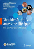 Shoulder Arthritis across the Life Span
