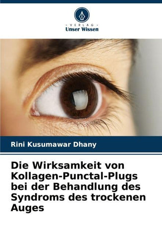 Die Wirksamkeit von Kollagen-Punctal-Plugs bei der Behandlung des Syndroms des trockenen Auges