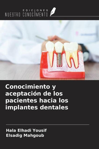 Conocimiento y aceptación de los pacientes hacia los implantes dentales