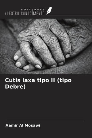 Cutis laxa tipo II (tipo Debre)