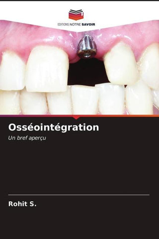 Osséointégration