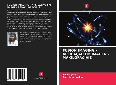 FUSION IMAGING - APLICAÇÃO EM IMAGENS MAXILOFACIAIS