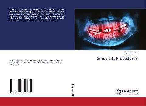 Sinus Lift Procedures