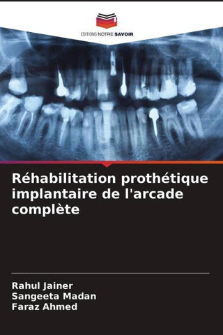 Réhabilitation prothétique implantaire de l'arcade complète