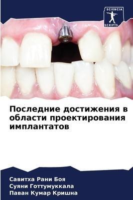 Poslednie dostizheniq w oblasti proektirowaniq implantatow