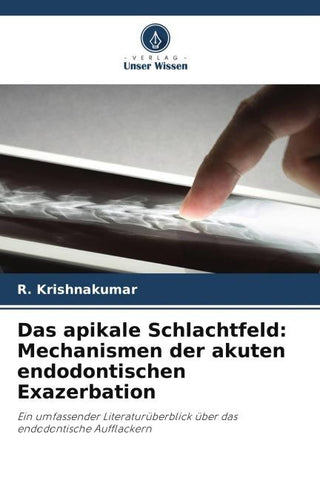 Das apikale Schlachtfeld: Mechanismen der akuten endodontischen Exazerbation