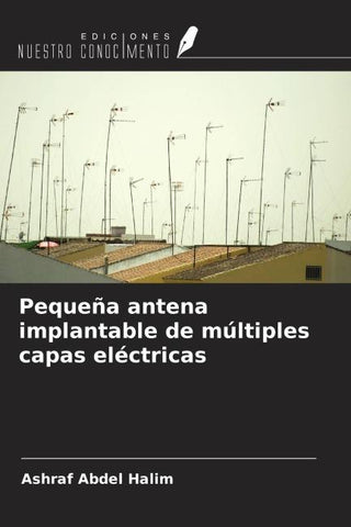 Pequeña antena implantable de múltiples capas eléctricas